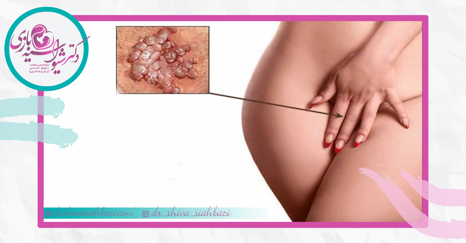 بی کلرواستیک اسید و تری کلرواستیک اسید