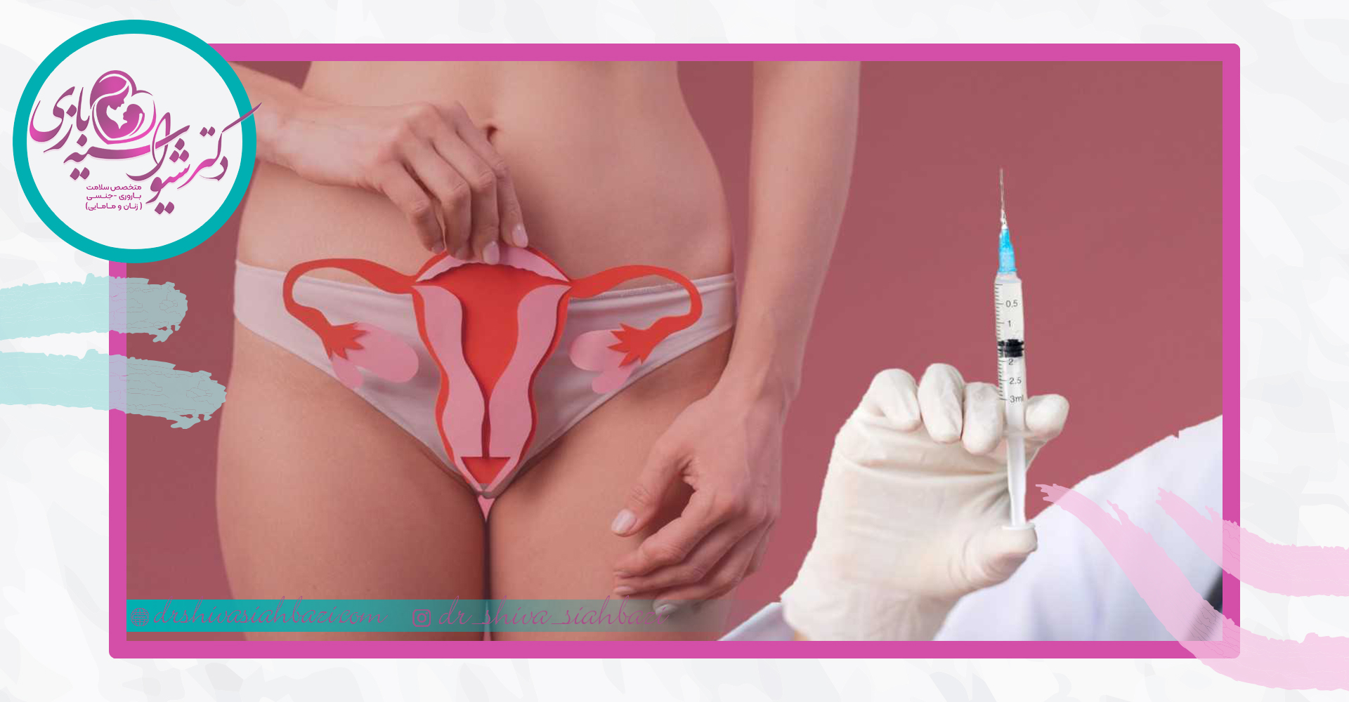 درمان واژینیسموس چقدر طول میکشد؟