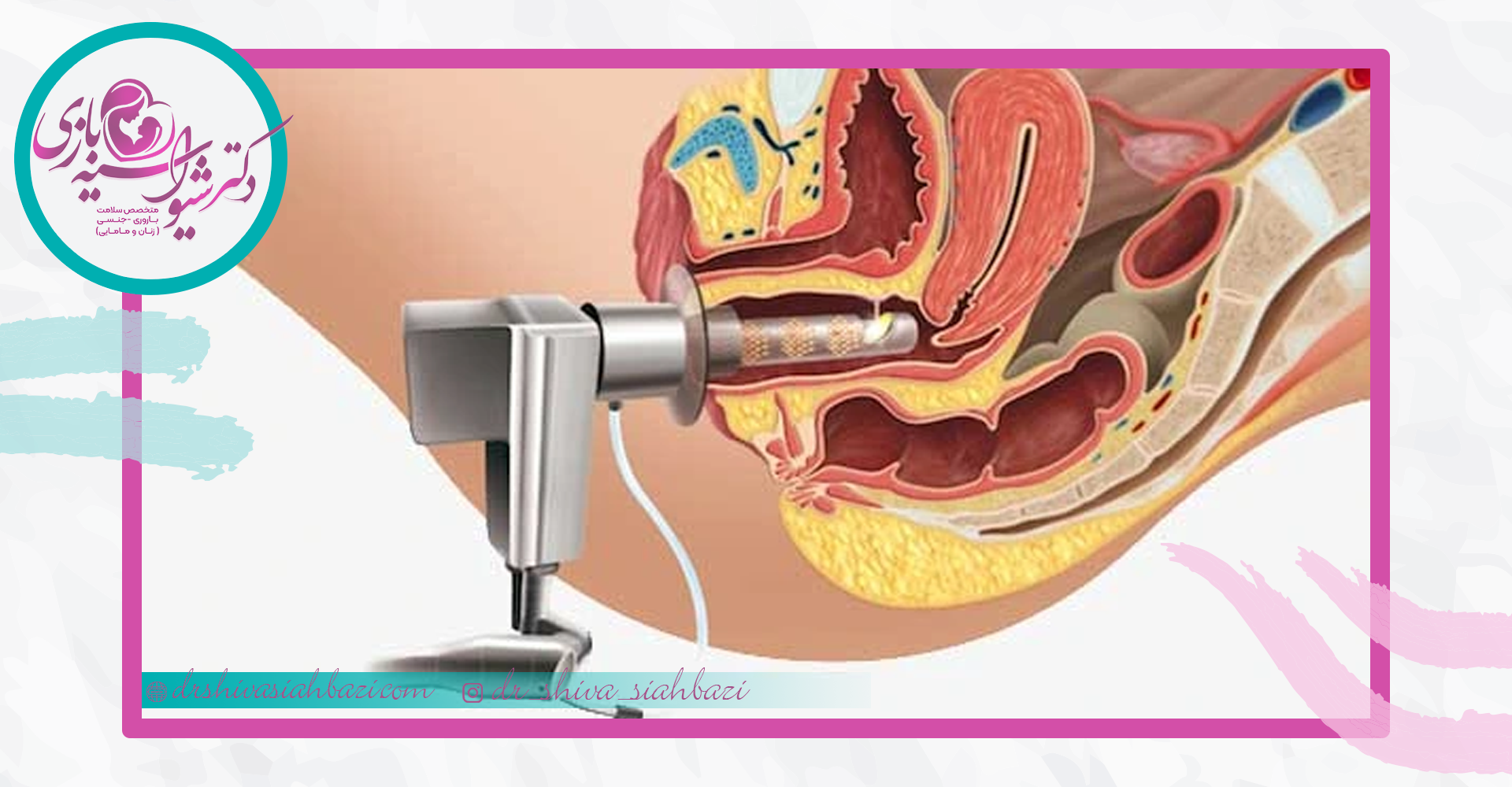 دستگاه هیگز چگونه کار میکند؟
