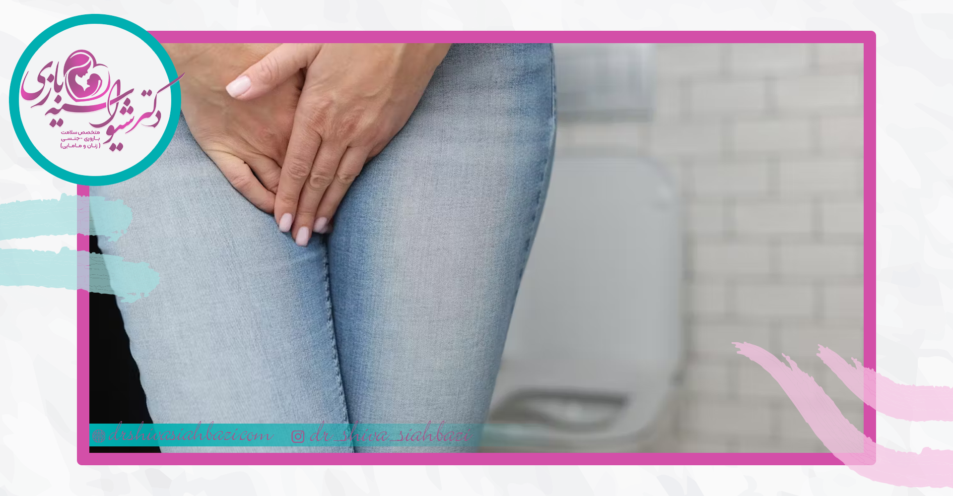 مثانه پیش فعال