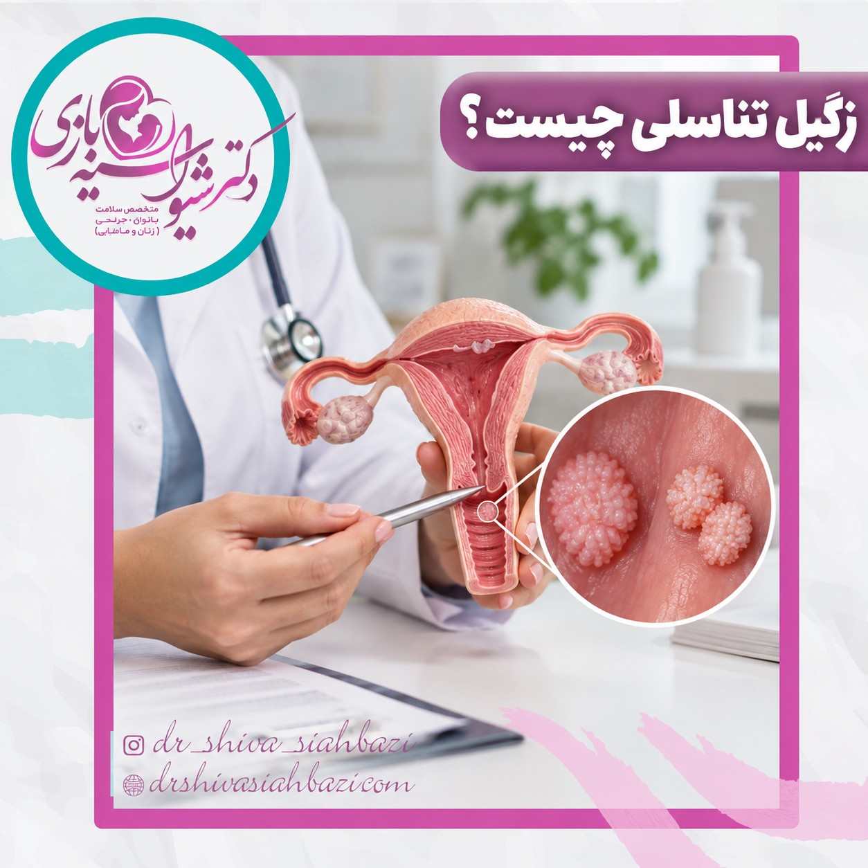 زگیل تناسلی چیست؟